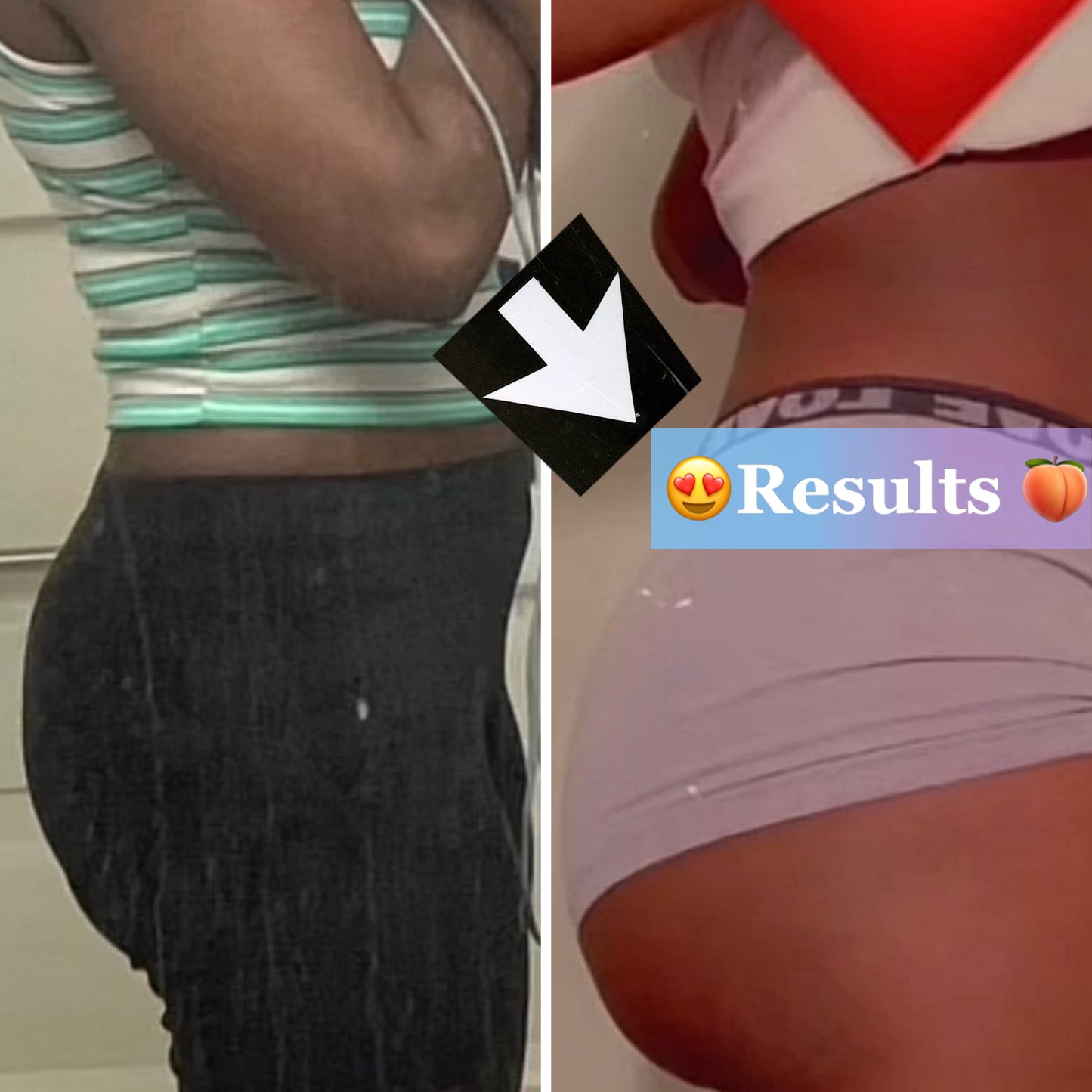 Boobs And Butt Enhancement - WaistMagnet