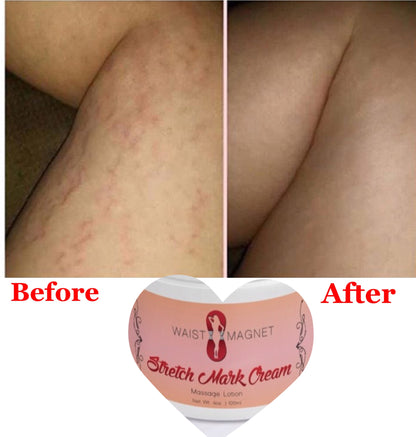 3 Pack Stretch Mark Cream