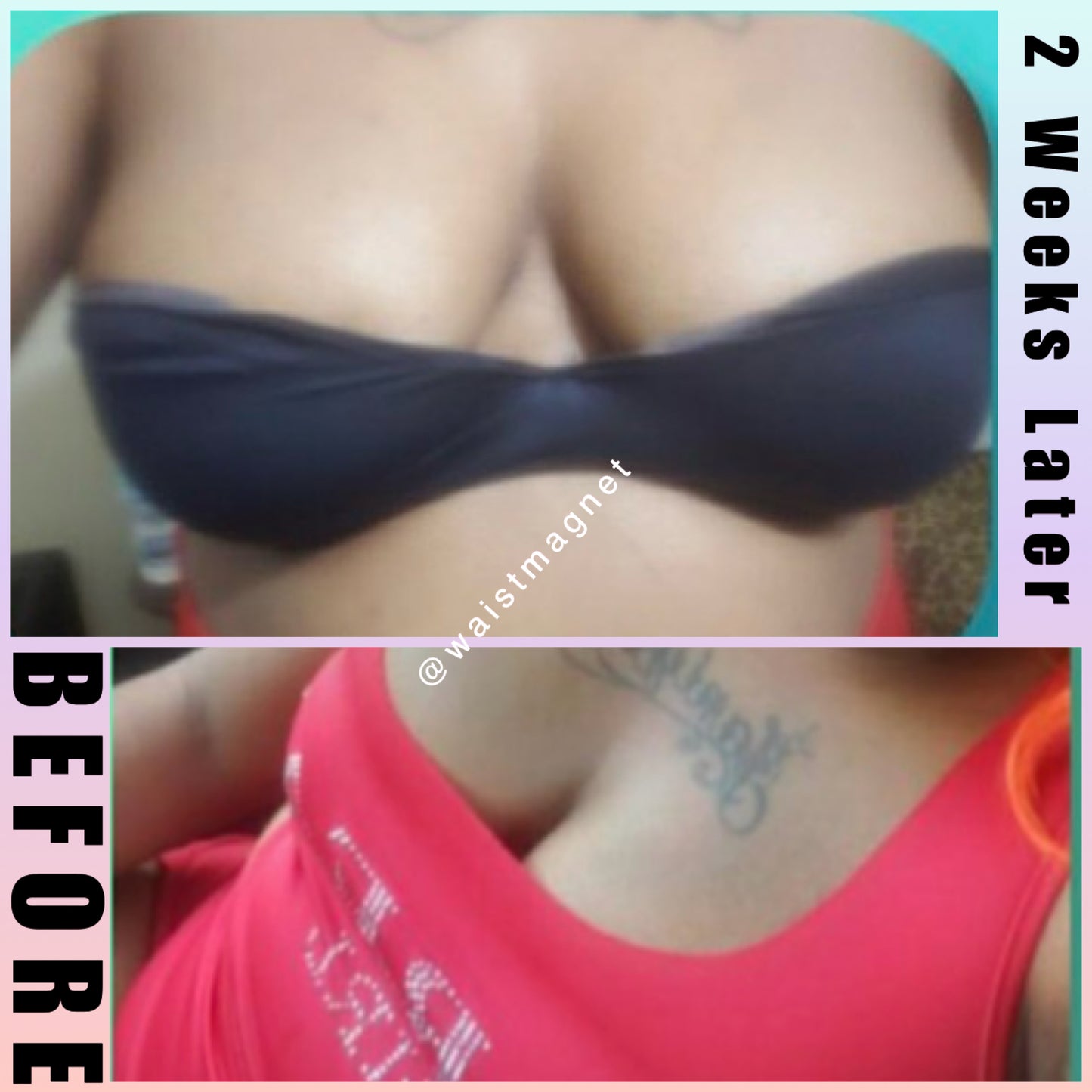 Breast Enhancement Cream