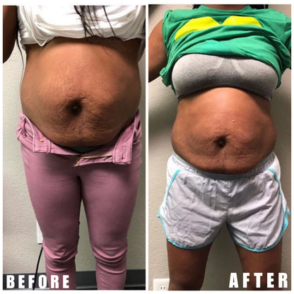 Body Sculpt Cream (Extreme)™