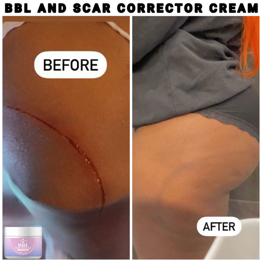 BBL And Scar Corrector Cream