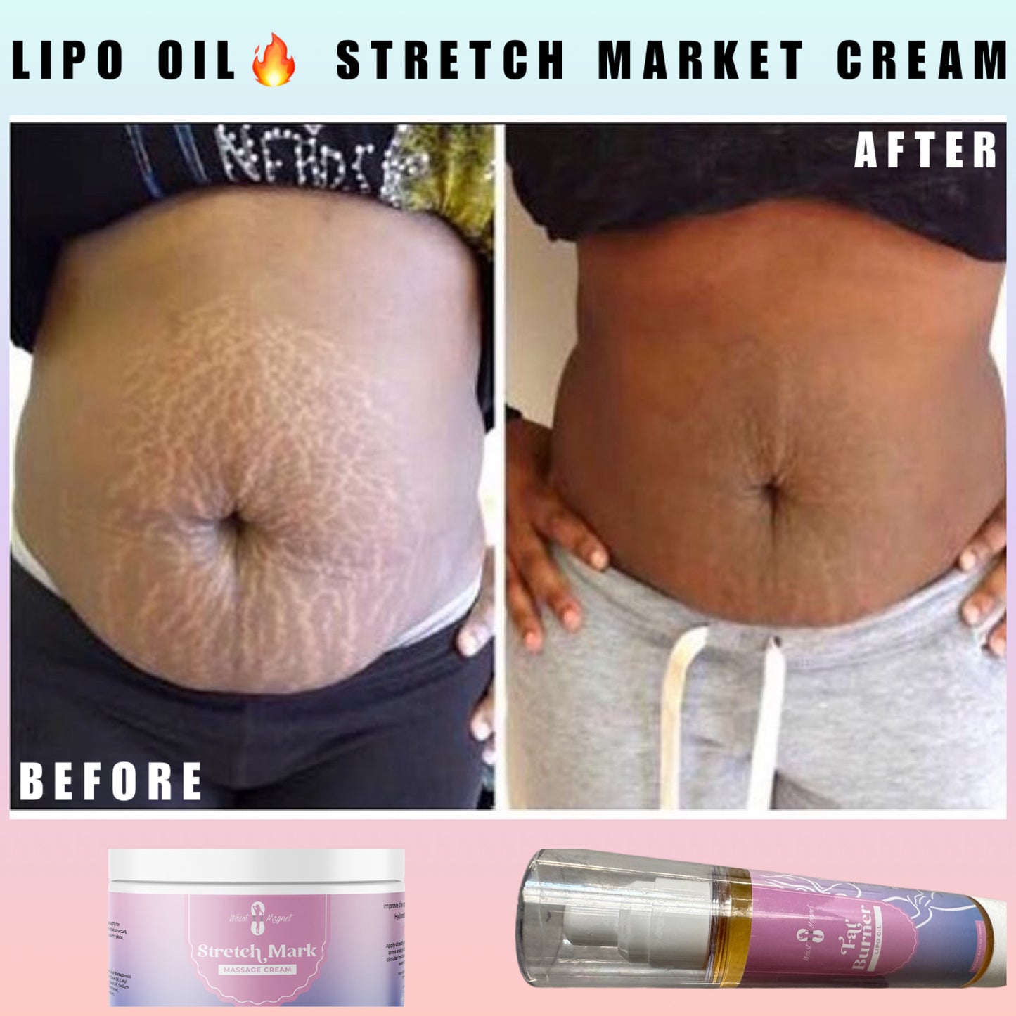 Lipo Oil & Stretch Mark Cream Combo